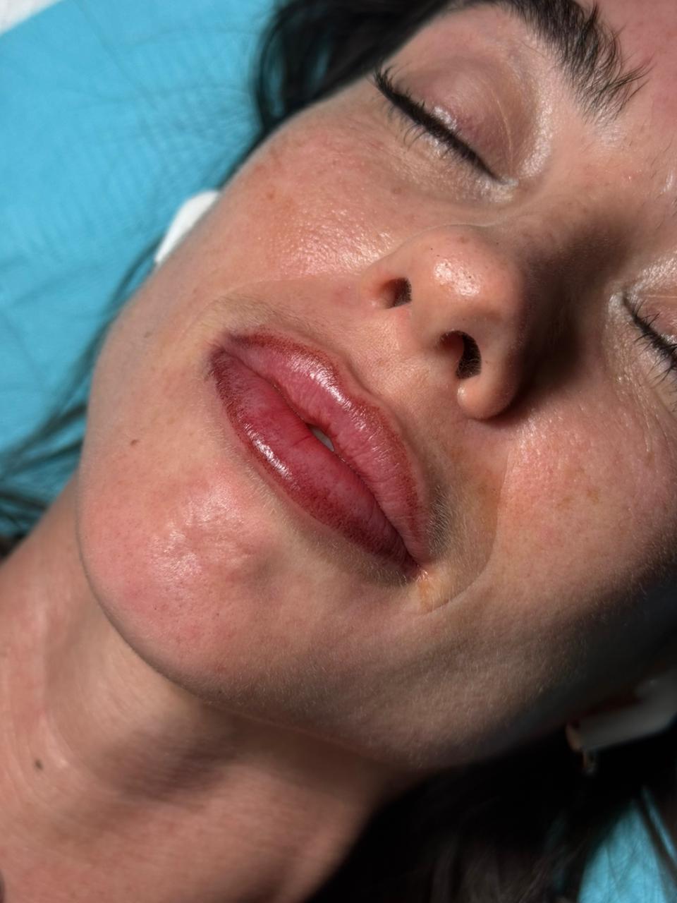 Healed lip blushing result photographed in natural daylight